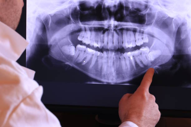 Best Emergency Broken Tooth Repair in Nice, CA