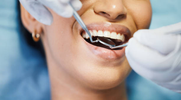 Best Emergency Root Canal Treatment in Nice, CA